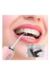 Irrigador Bucal Portátil Limpieza Dental Salud Recargable Irrigador Bucal Portátil Limpieza Dental Salud Recargable
