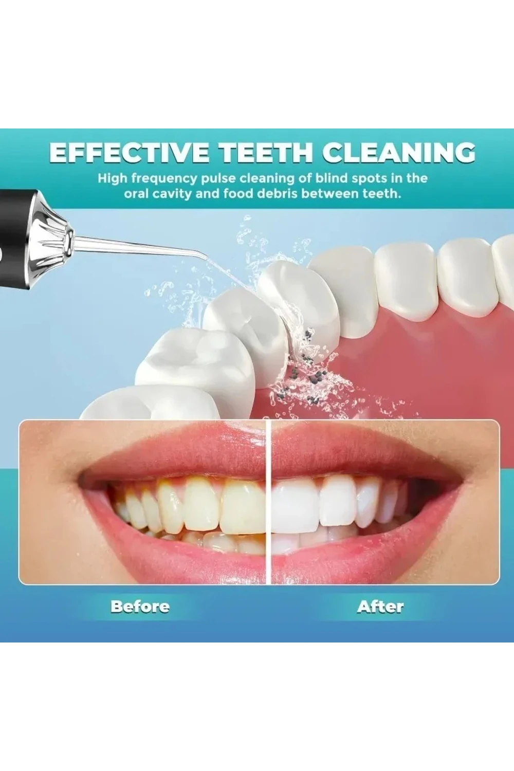 Irrigador Bucal Portátil Limpieza Dental Salud Recargable Irrigador Bucal Portátil Limpieza Dental Salud Recargable