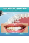 Irrigador Bucal Portátil Limpieza Dental Salud Recargable Irrigador Bucal Portátil Limpieza Dental Salud Recargable