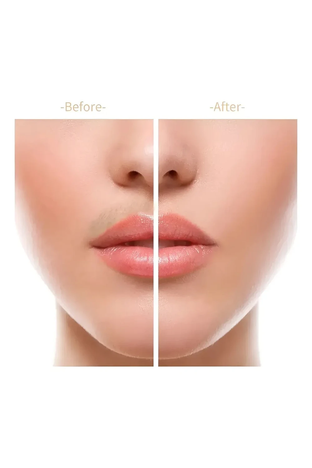Removedor De Vello Facial Femenino Rasurador Depiladora Removedor De Vello Facial Femenino Rasurador Depiladora